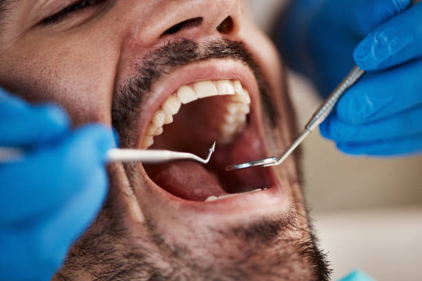 Best Emergency Dental Care for Broken or Chipped Teeth in Kerens, TX