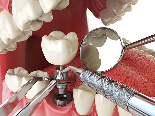 Best Emergency Root Canal Treatment in Kerens, TX